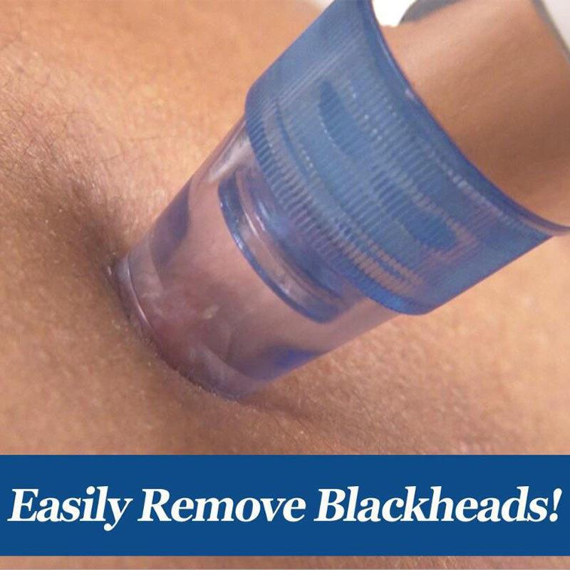 PORE-X™ (Blackhead Remover Device)